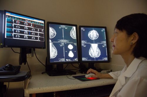 人工智慧偵測乳癌