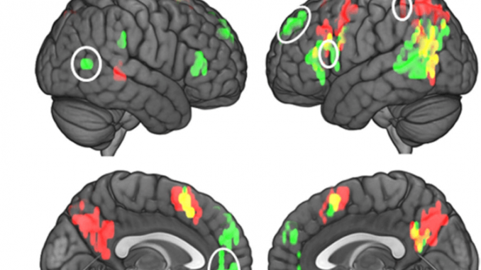 fMRI image