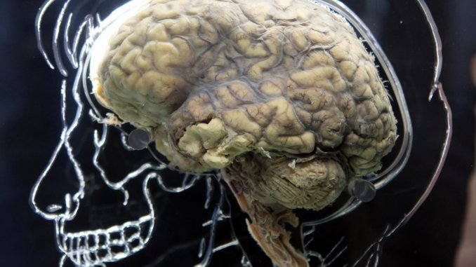 人體大腦
