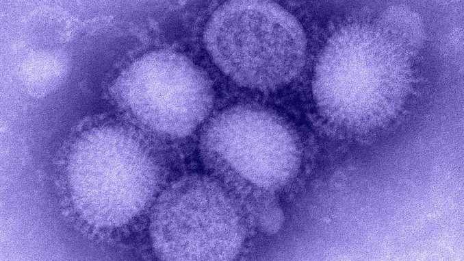 H1N1_influenza_virus