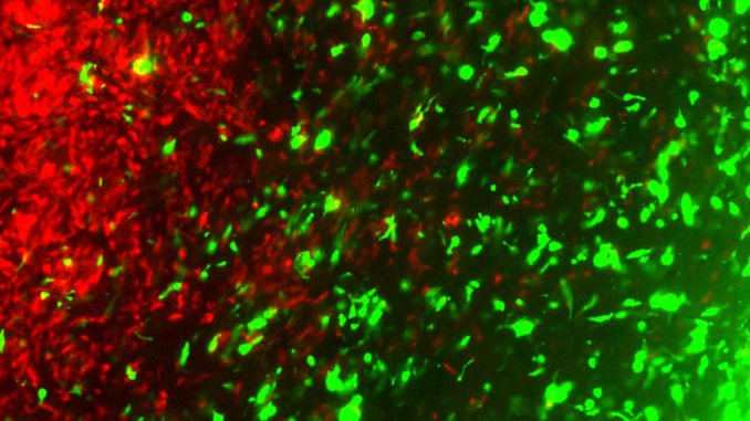 經過 CRISPR 改造的癌細胞(綠色)能夠釋放致命蛋白殺死腫瘤細胞(紅色)