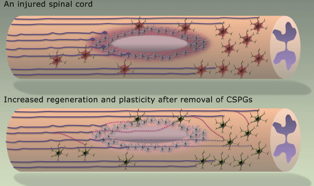 CSPGs and ChABC in spinal cord injury