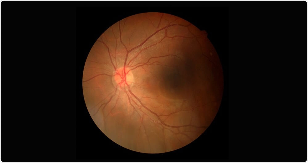 科學家以石墨烯開發出人工視網膜
