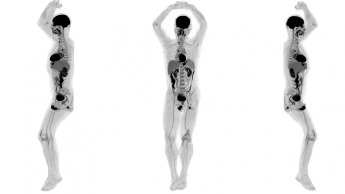 body scan