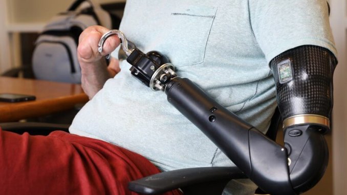 prosthetic