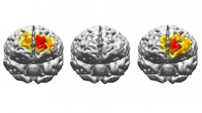 electrostimulation-brain-comparison