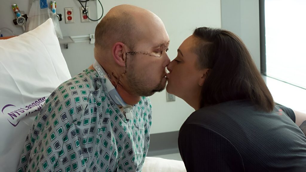 阿隆·詹姆斯（左）在紐約NY Langone Health從首次全眼和部分面部移植手術中恢復期間，親吻他的妻子梅根。