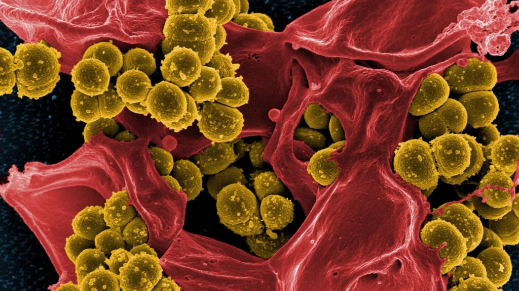 服用36天即抑制超級細菌
耐甲氧西林的金黃色葡萄球菌(黃色)與人類白血球(紅色)